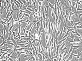 Image: Photomicrograph of human hepatic stellate cells under phase contrast (Photo courtesy of ScienCell Research Laboratories). 